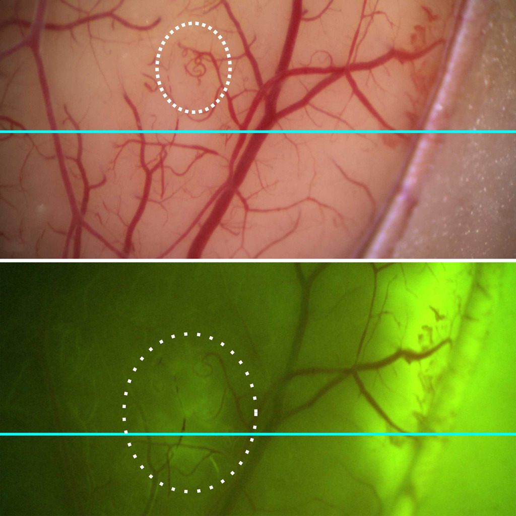 Researchers integrate fast OCT system into neurosurgical microscope