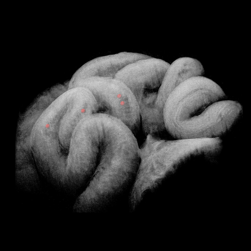 Researchers use OCT imaging to uncover how the fallopian tube transports embryos