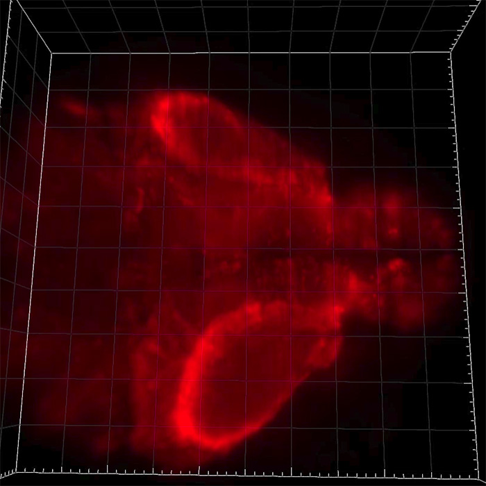 High-speed 3D imaging reveals how seizures move through the brain