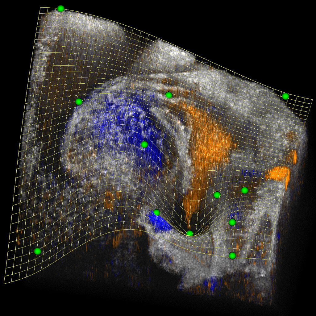 Better 3D and 4D Visualization of Biomedical Images
