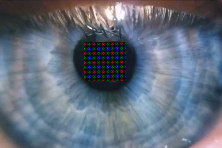 Newly developed submicrometer pixels on an eye