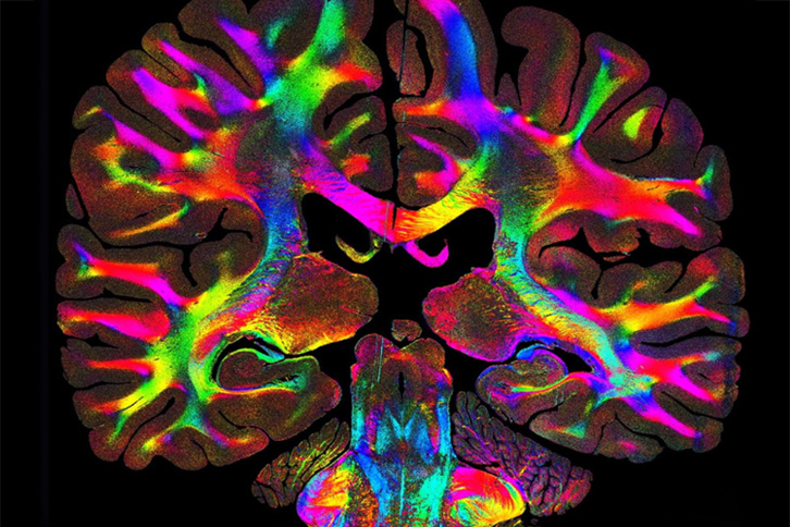 Illustration of tissue fibers in the brain